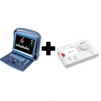 Pack ahorro: Ecógrafo Chison ECO 5 con sonda lineal de 10 MHz + APS e4 dispositivo de electrólisis percutánea terapéutica Pack ahorro: Ecógrafo Chison ECO 5 con sonda lineal de 10 MHz + APS e4 dispositivo de electrólisis percutánea terapéutica